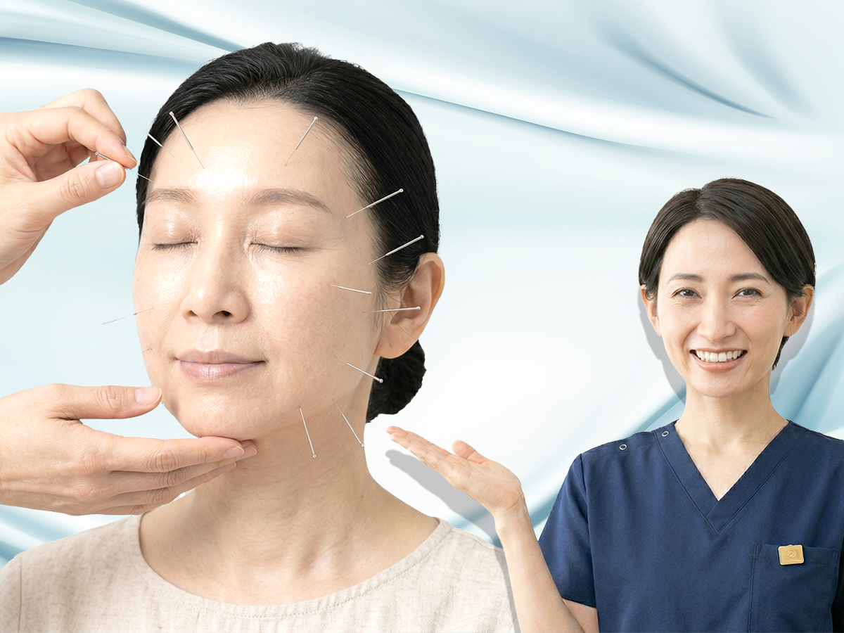 美容鍼のご予約案内イメージ